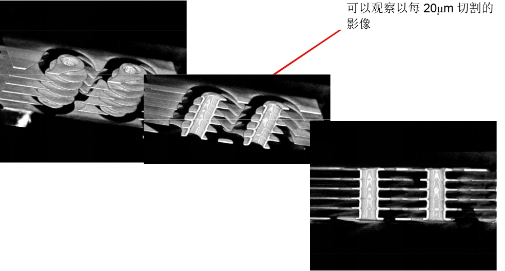 CT扫描3合1